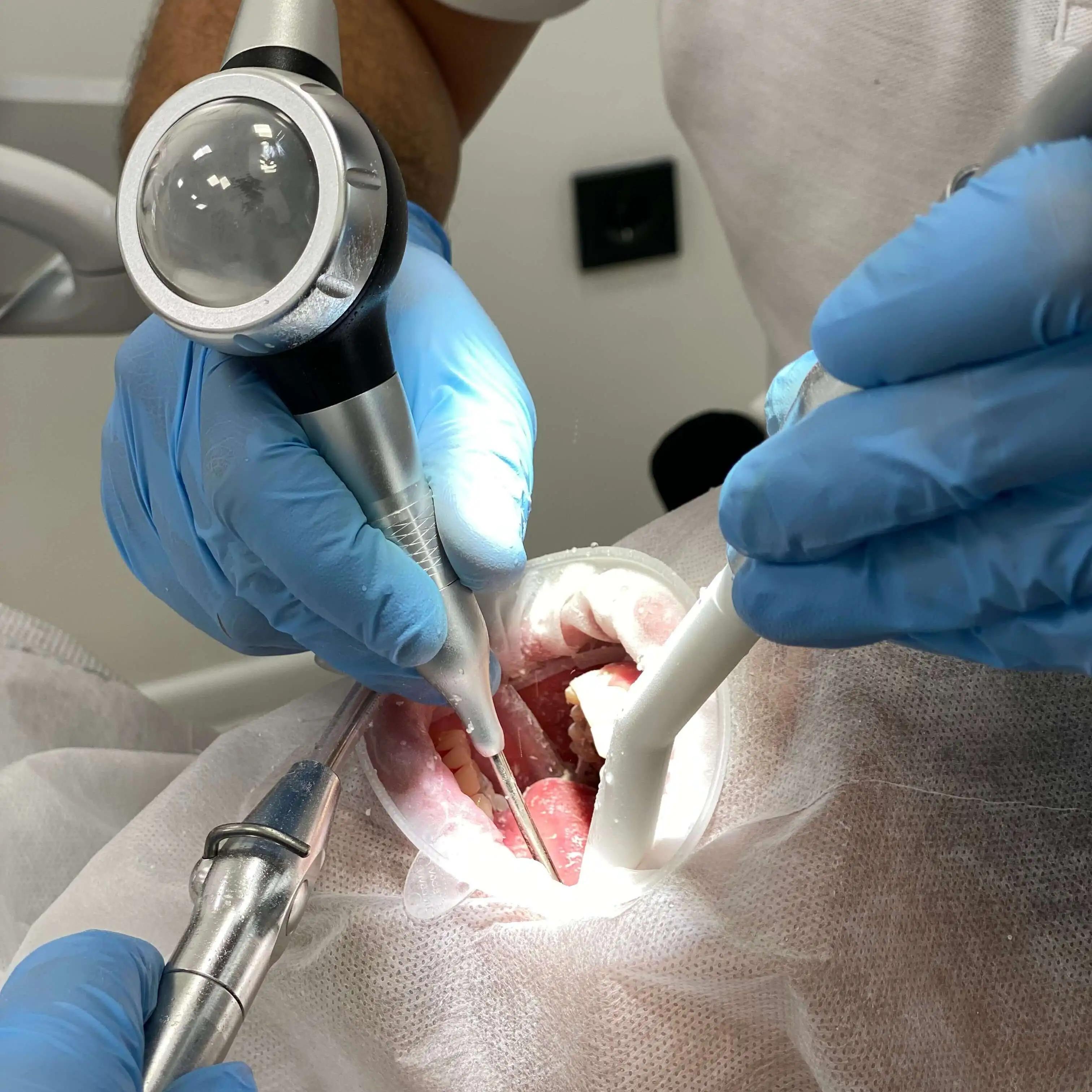 Професійна гігієна порожнини рота: Чому вона важлива?